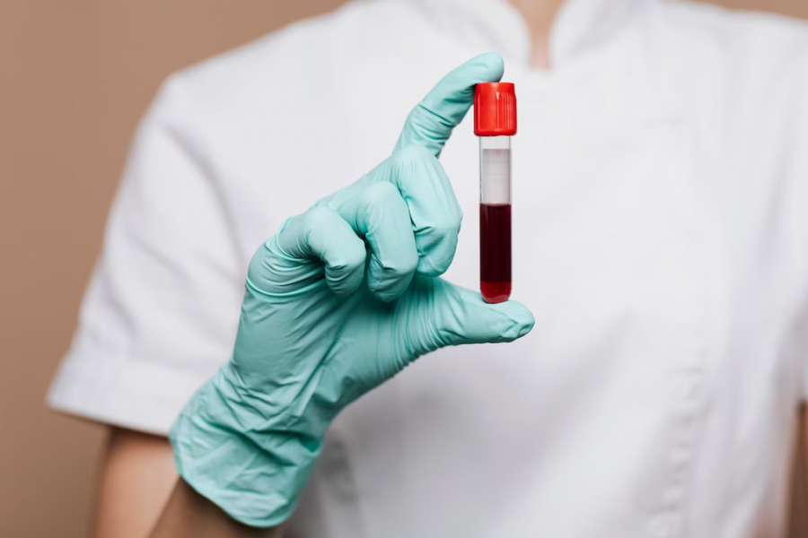 Analisis de sangre dieta personalizada