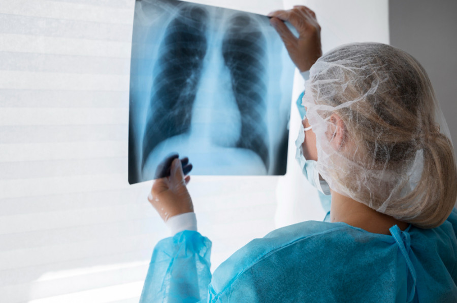 Asocian por primera vez la aparición del cáncer de pulmón con la dieta