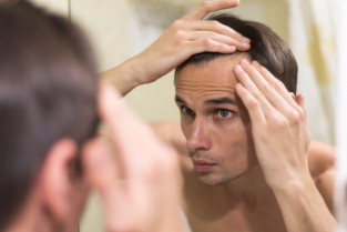 ¿La creatina causa caída del cabello?