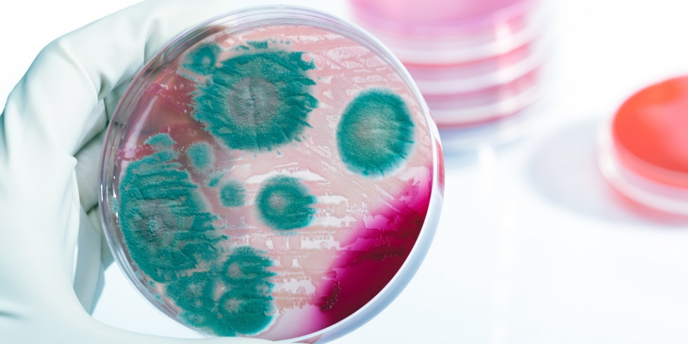 Incrementan los casos de listeriosis en Europa pero se reducen en España