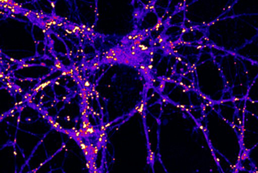 Sinapsis cerebro grasa